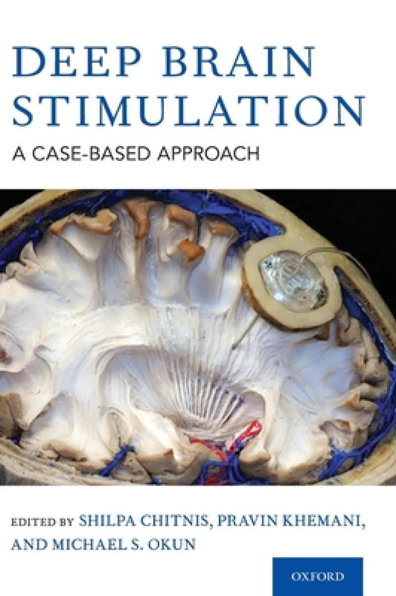 Deep Brain Stimulation