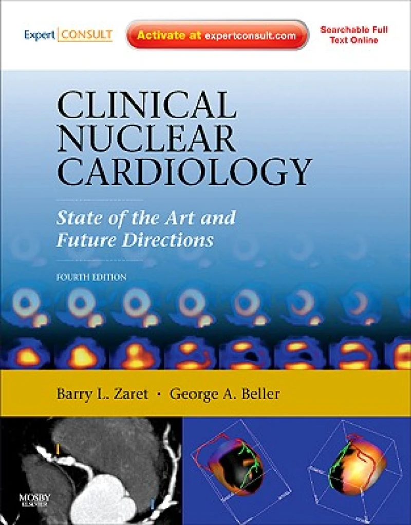 Clinical Nuclear Cardiology: State of the Art and Future Directions
