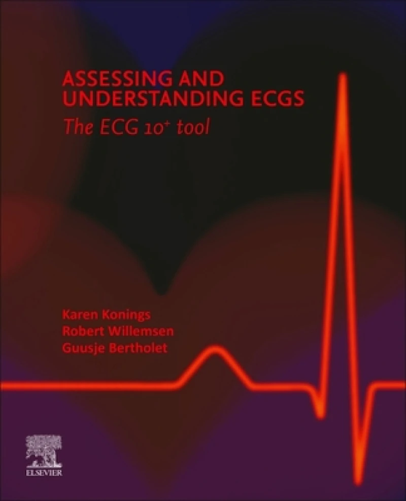 Assessing and Understanding ECGs: The ECG10+ tool