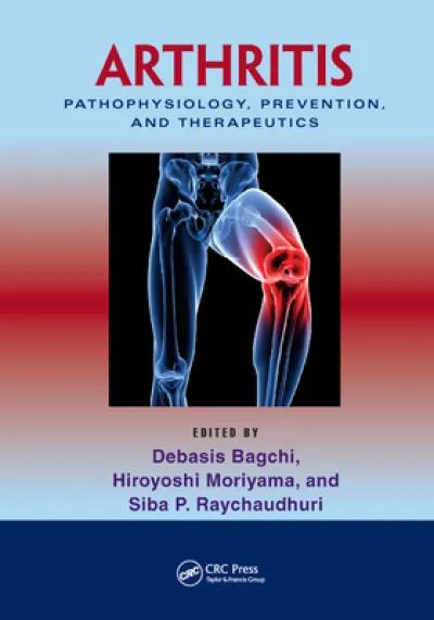 Arthritis