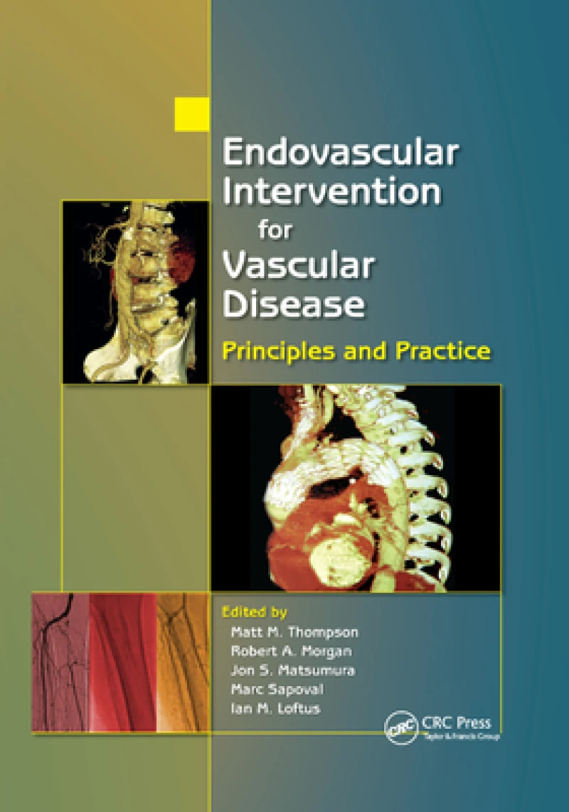 Endovascular Intervention for Vascular Disease