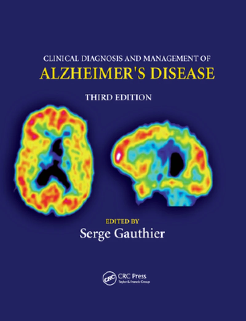 Clinical Diagnosis and Management of Alzheimer''s Disease