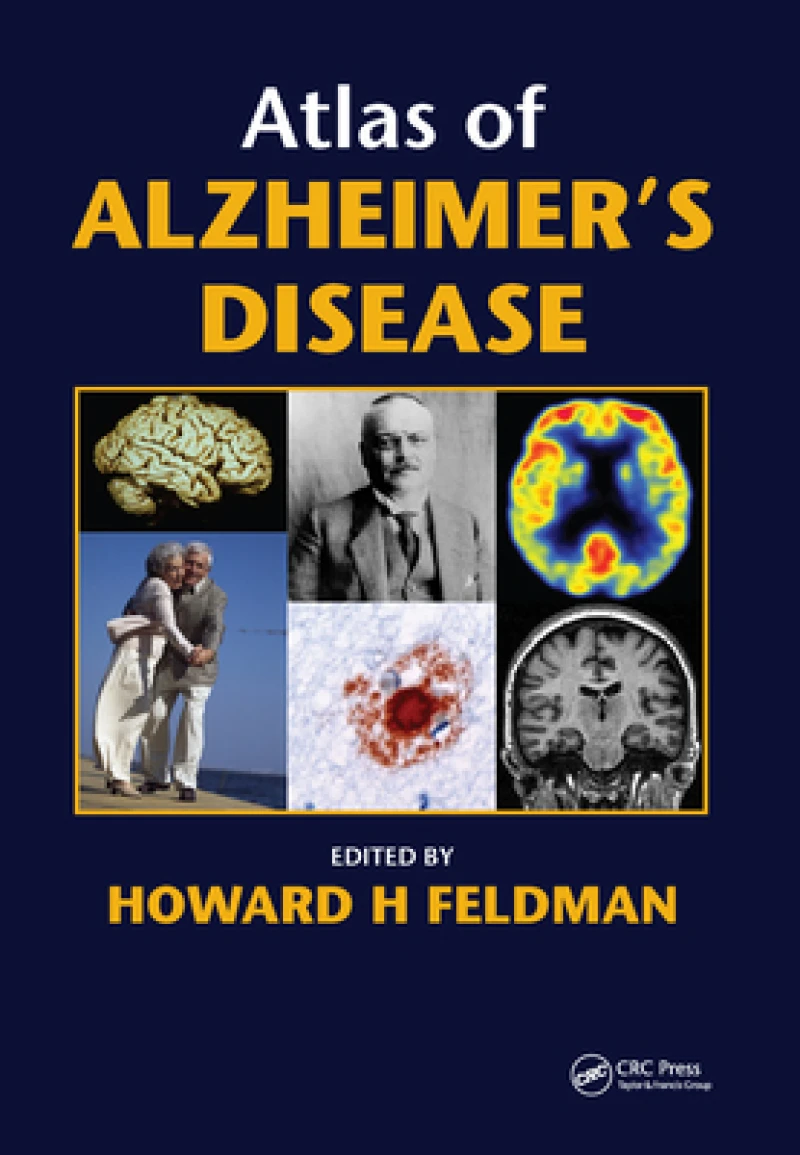 Atlas of Alzheimer''s Disease