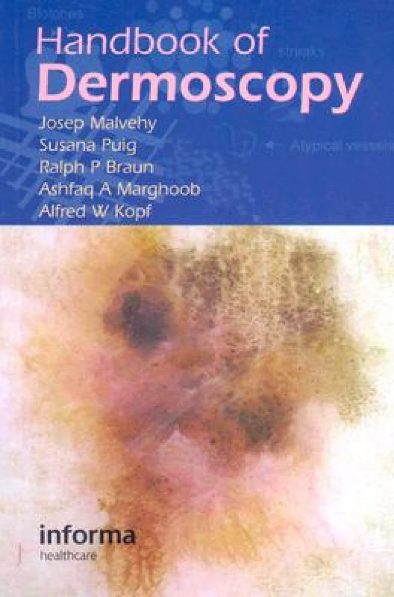 Handbook of Dermoscopy