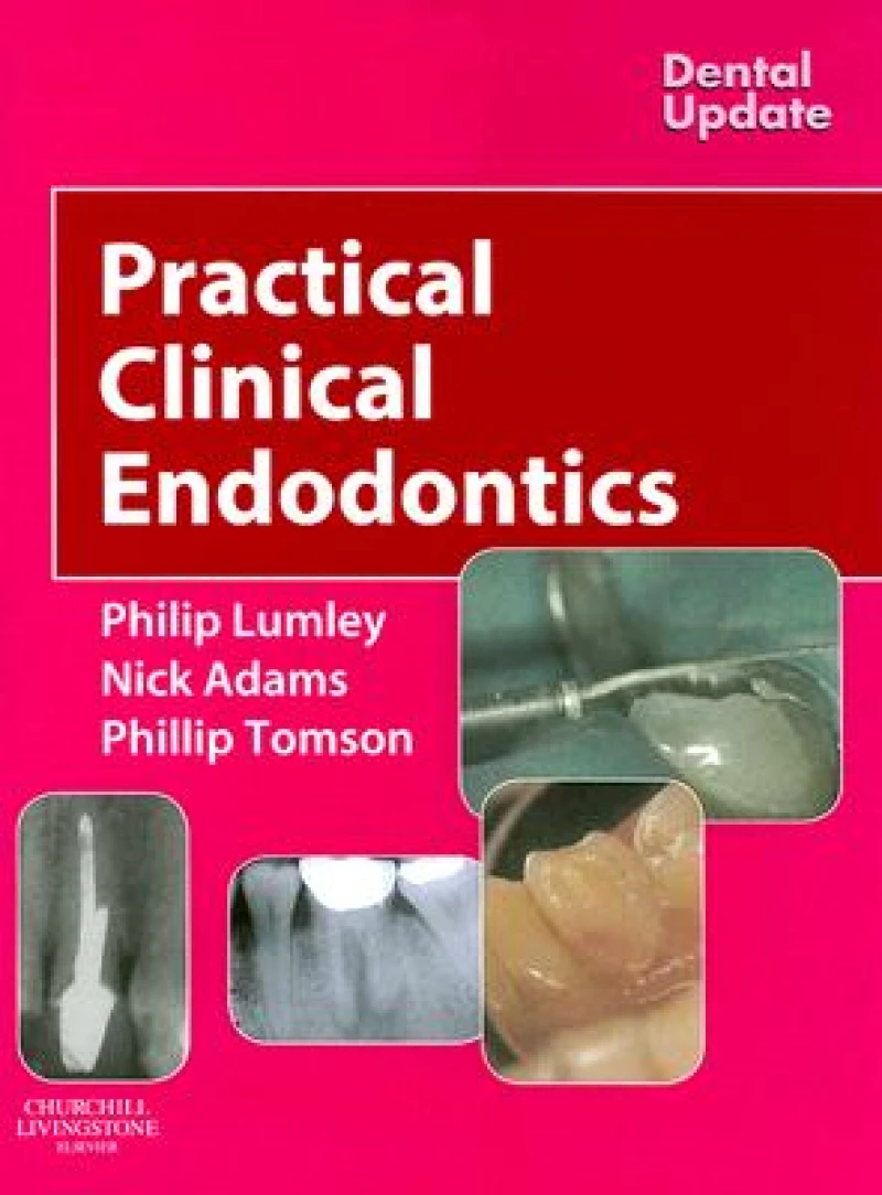 Practical Clinical Endodontics