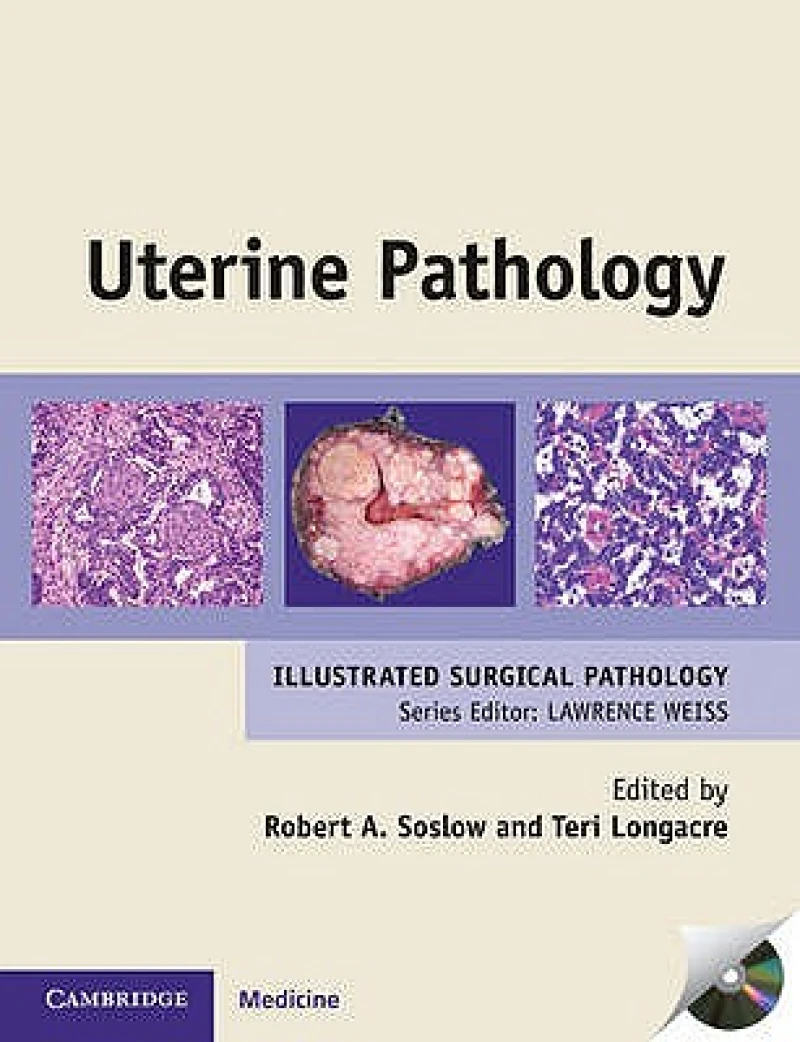 Uterine Pathology