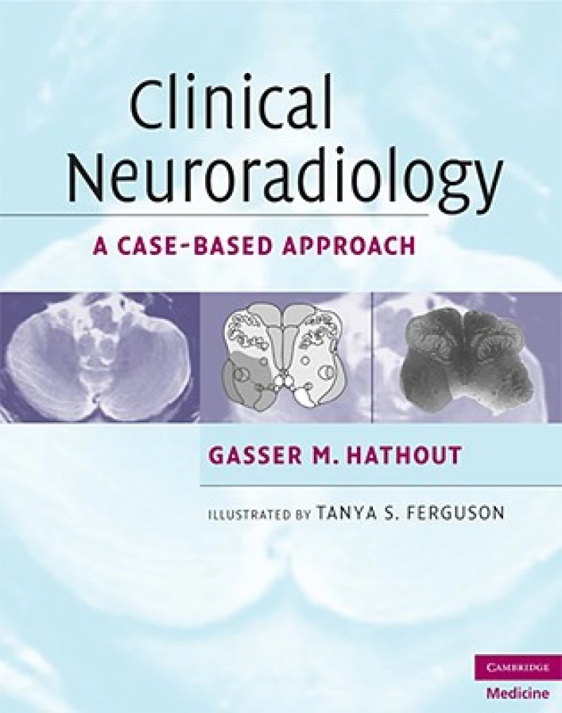 Clinical Neuroradiology