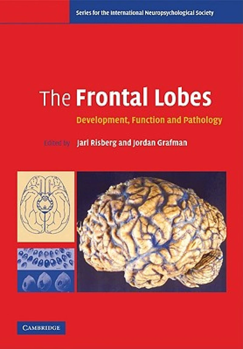 The Frontal Lobes