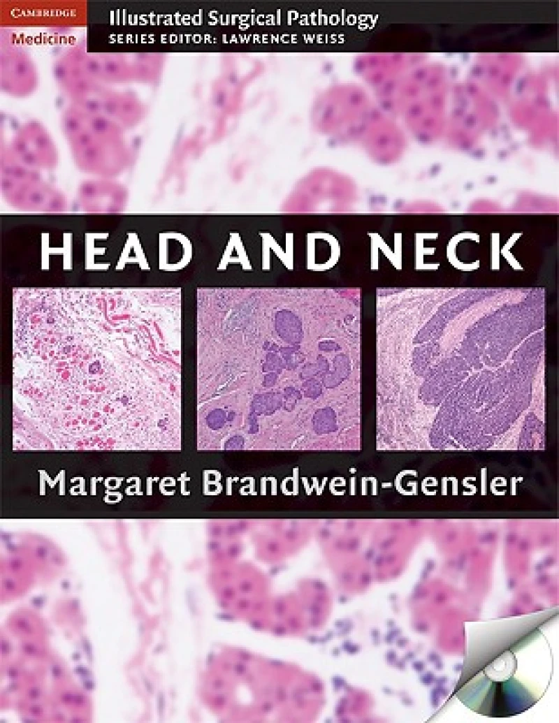 Head and Neck