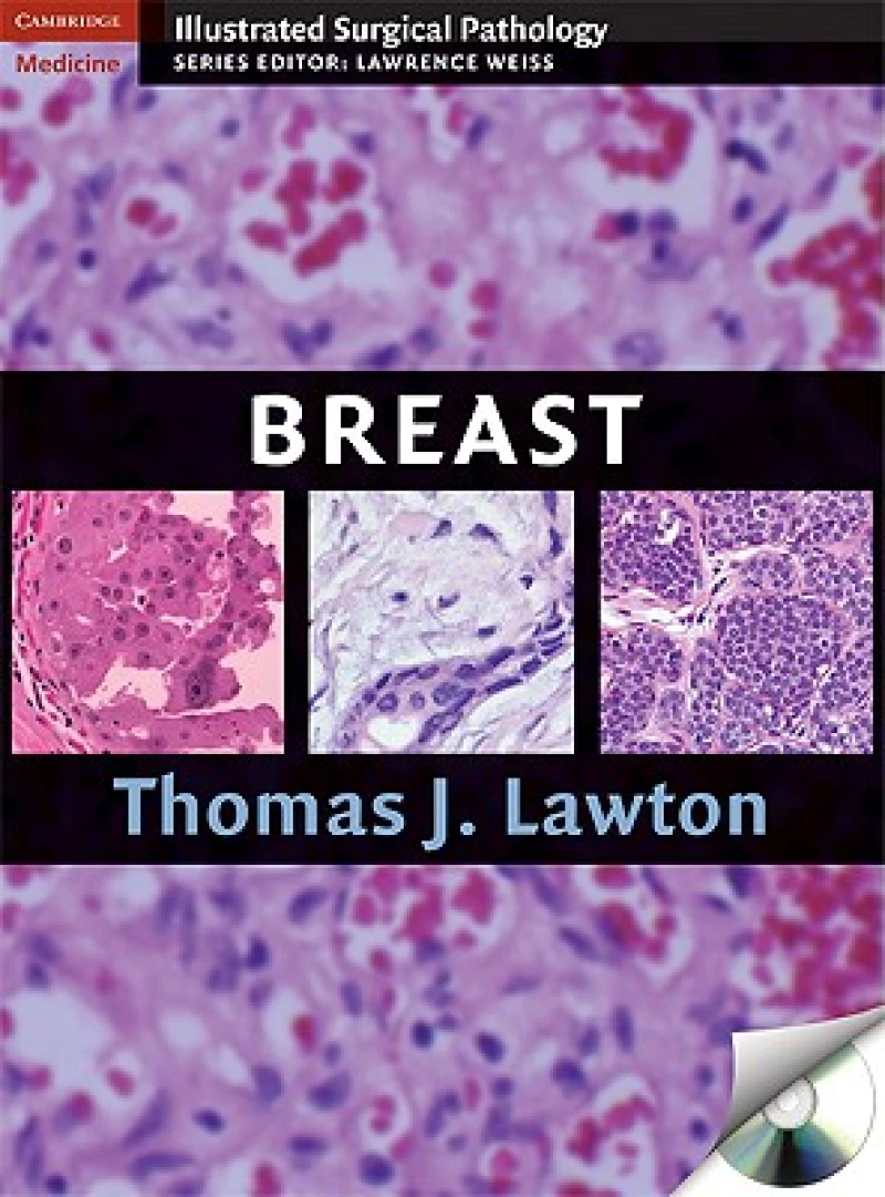 Breast