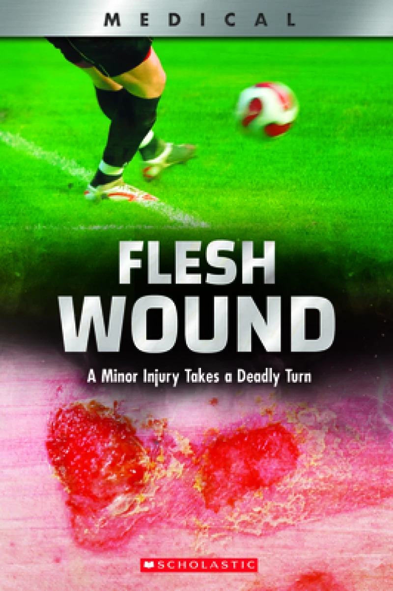 Flesh Wound: A Minor Injury Takes a Deadly Turn (XBooks)