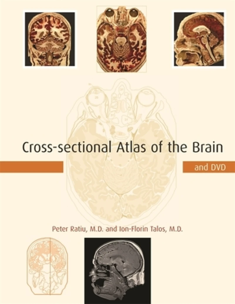 Cross-sectional Atlas of the Brain and DVD