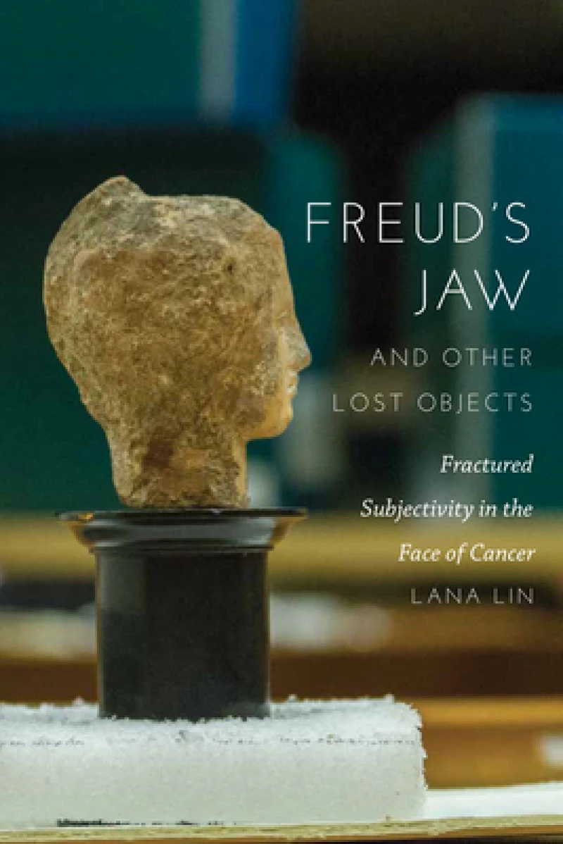 Freud''s Jaw and Other Lost Objects