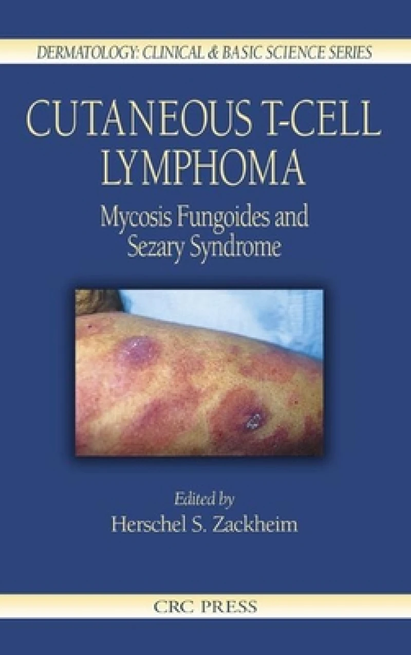 Cutaneous T-Cell Lymphoma