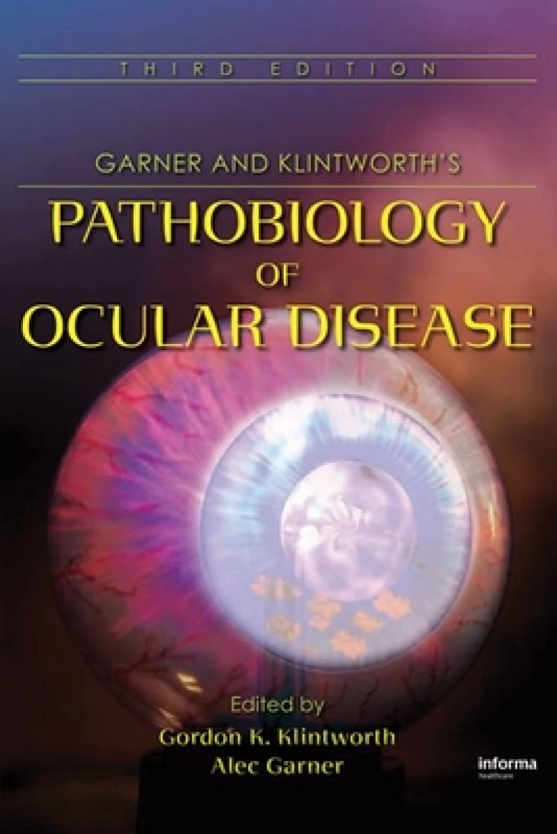 Pathobiology of Ocular Disease