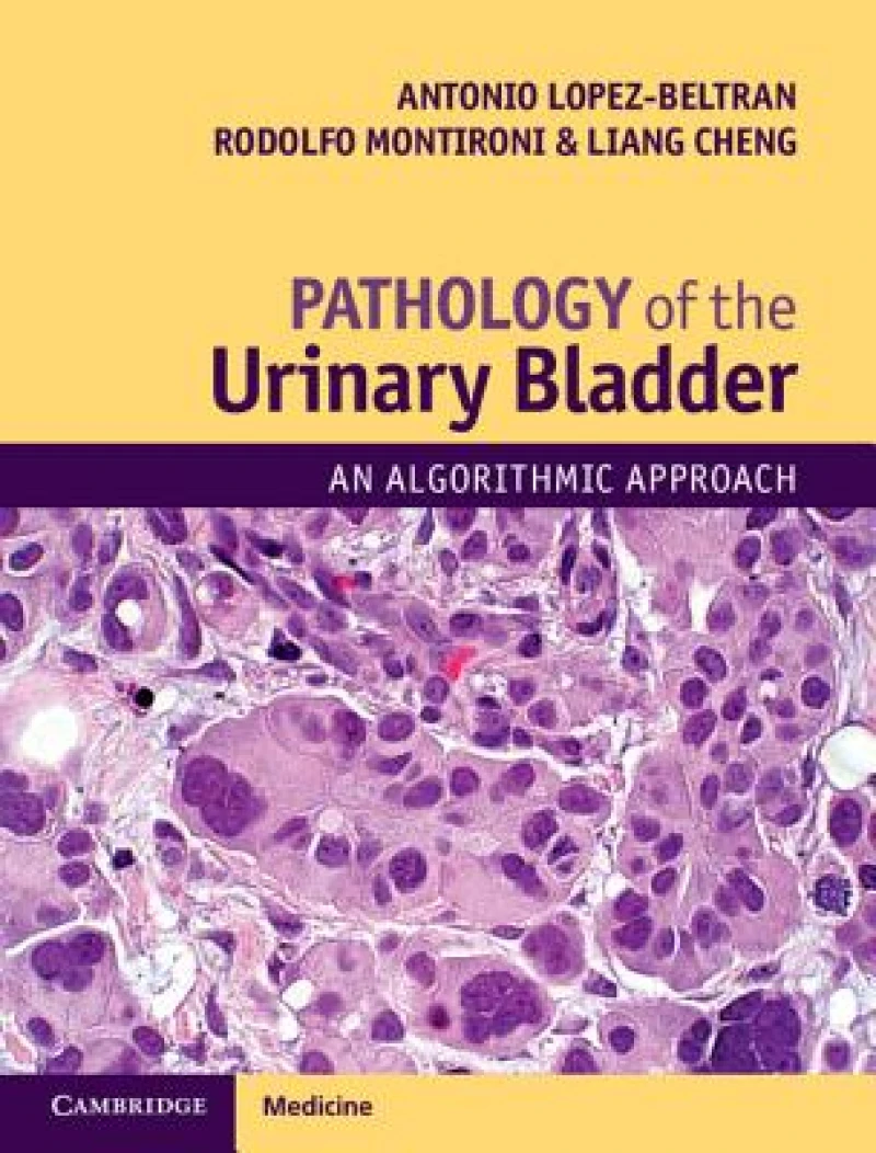 Pathology of the Urinary Bladder
