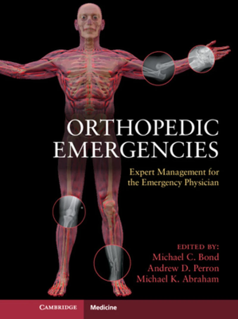 Orthopedic Emergencies