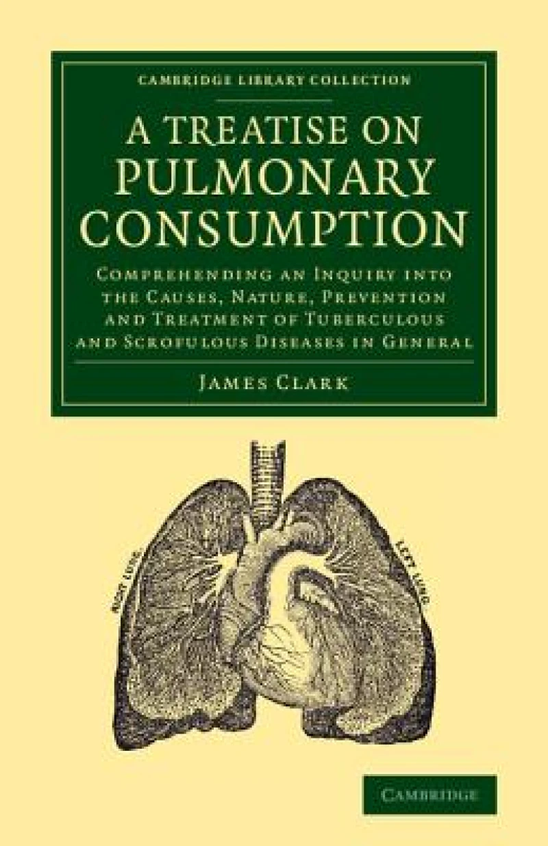 A Treatise on Pulmonary Consumption