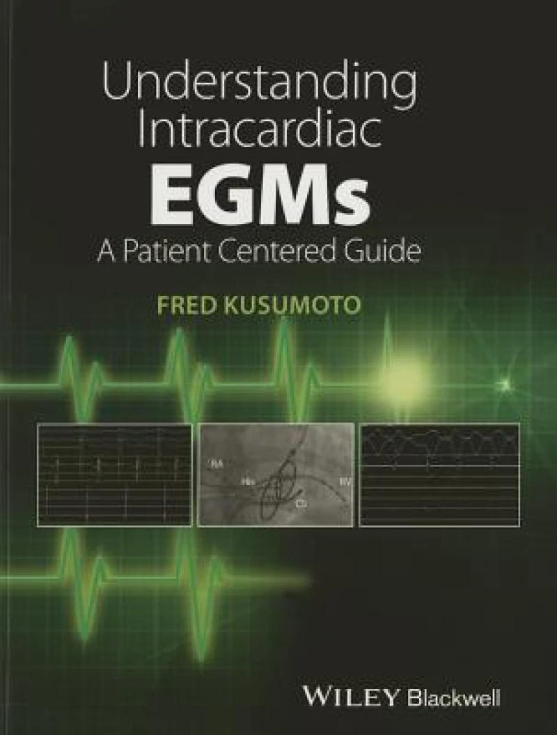 Understanding Intracardiac EGMs