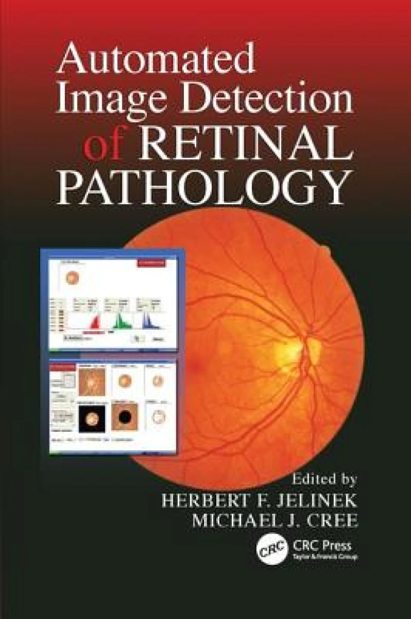Automated Image Detection of Retinal Pathology
