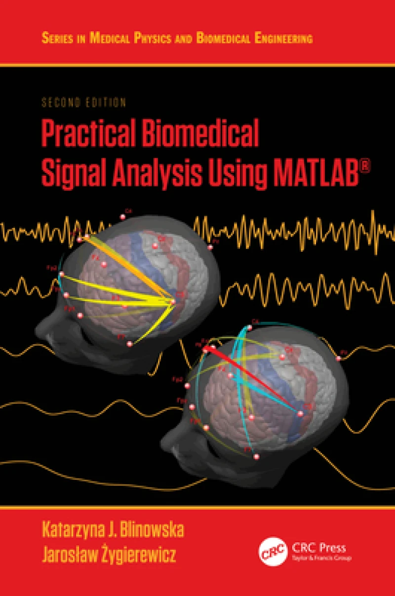 Practical Biomedical Signal Analysis Using MATLAB?