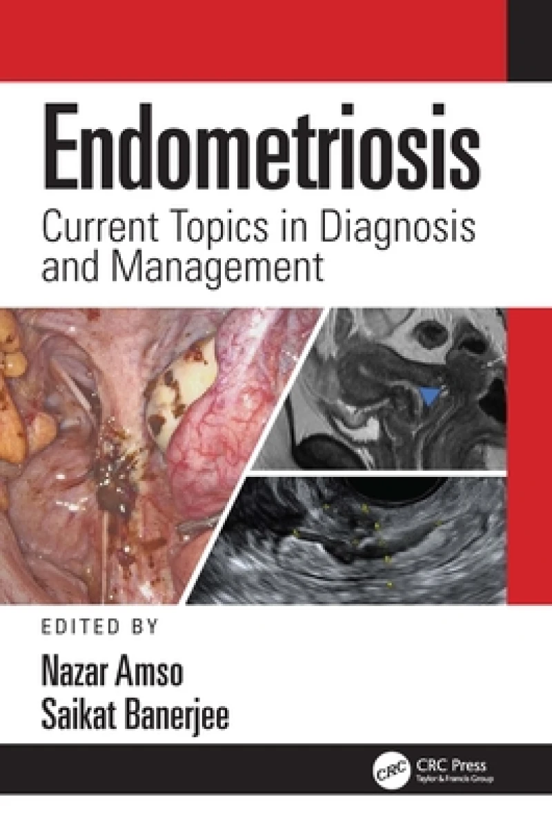 Endometriosis