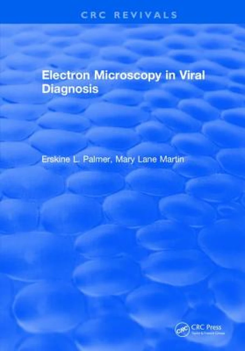 Electron Microscopy in Viral Diagnosis