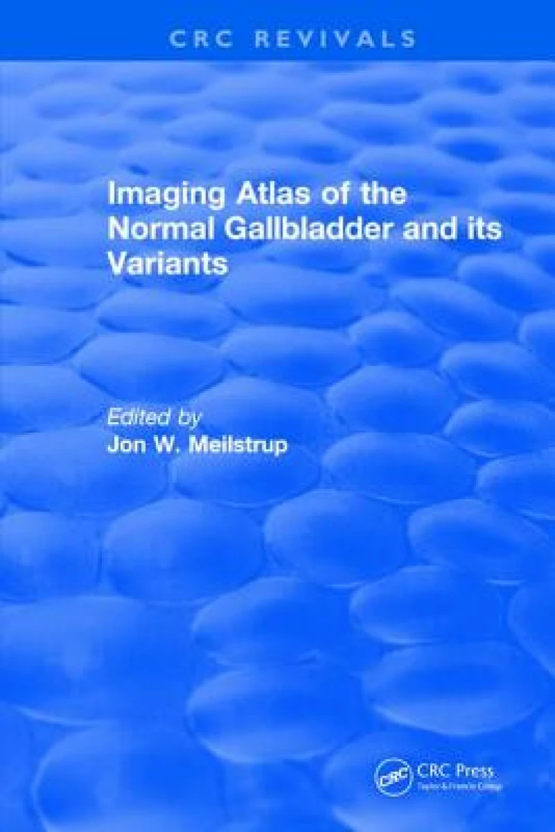Imaging Atlas of the Normal Gallbladder and Its Variants