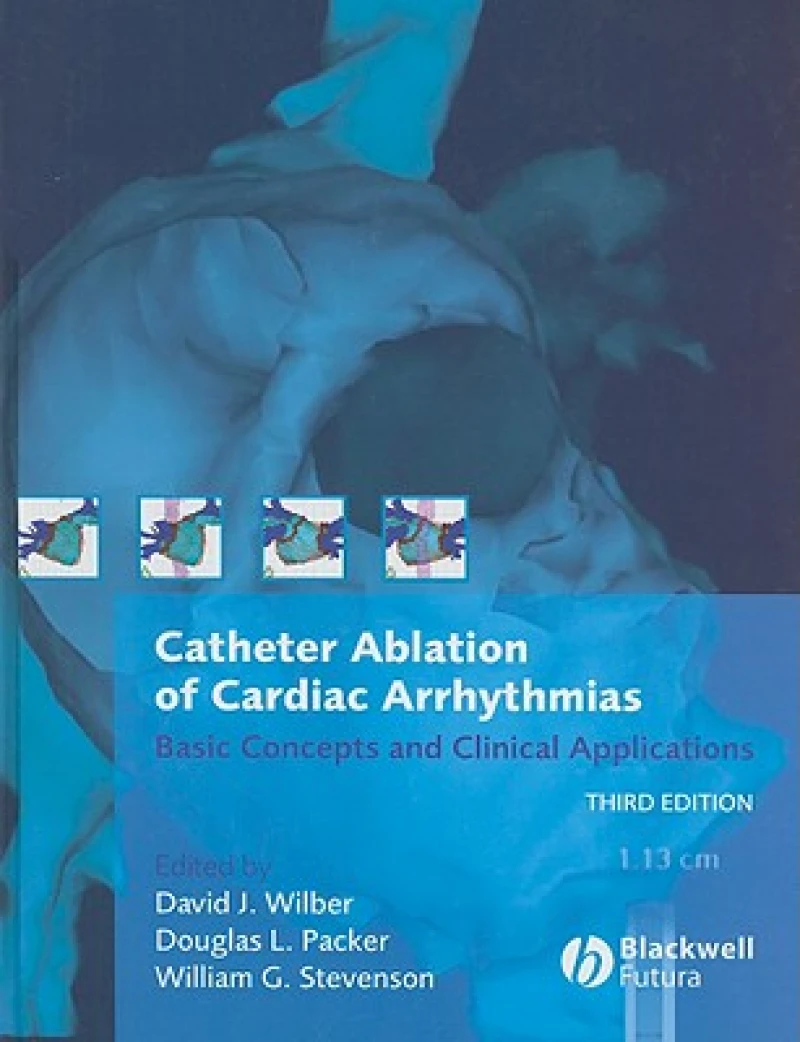 Catheter Ablation of Cardiac Arrhythmias – Basic Concepts and Clinical Applications 3e