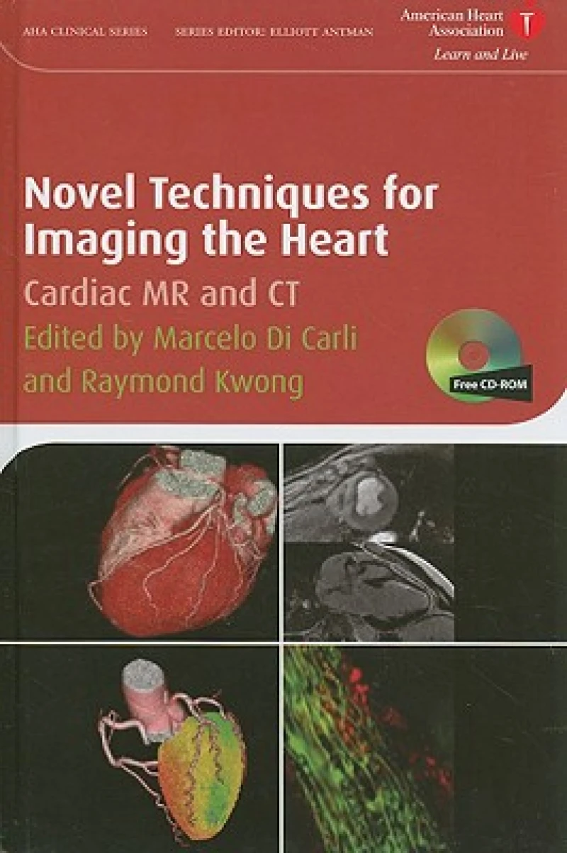 Novel Techniques for Imaging the Heart – Cardiac MR and CT