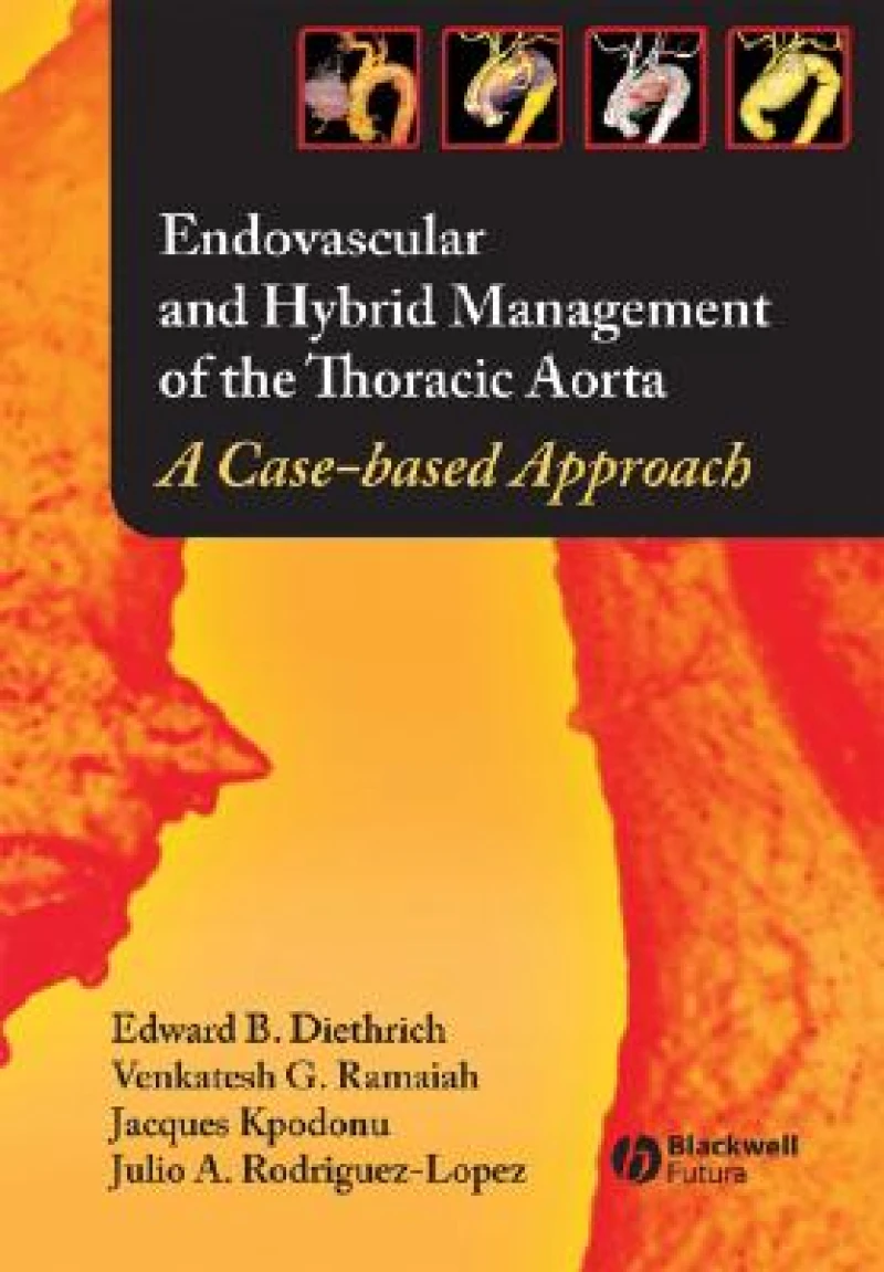 Endovascular and Hybrid Management of the Thoracic Aorta