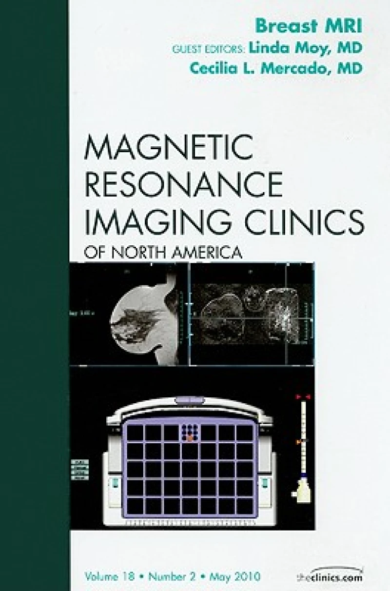 Breast MRI, An Issue of Magnetic Resonance Imaging Clinics