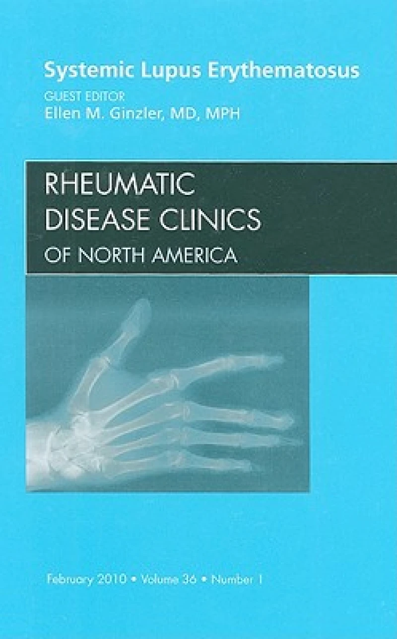 Systemic Lupus Erythematosus, An Issue of Rheumatic Disease Clinics
