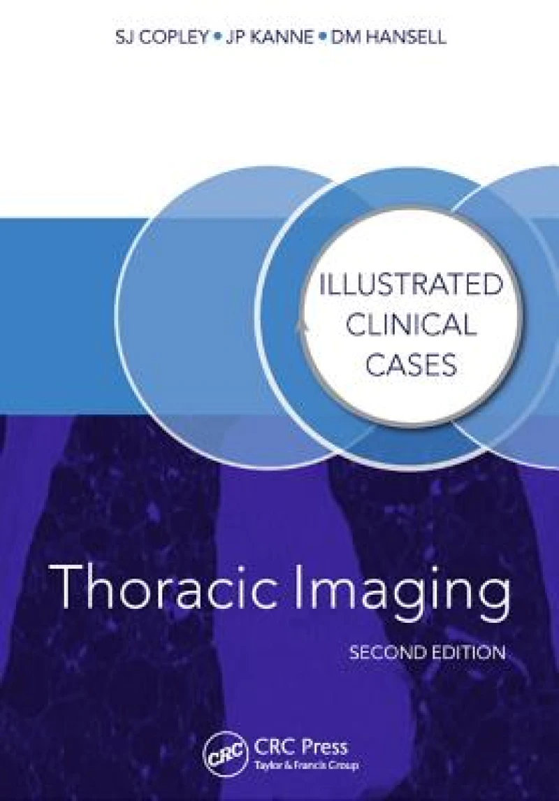 Thoracic Imaging