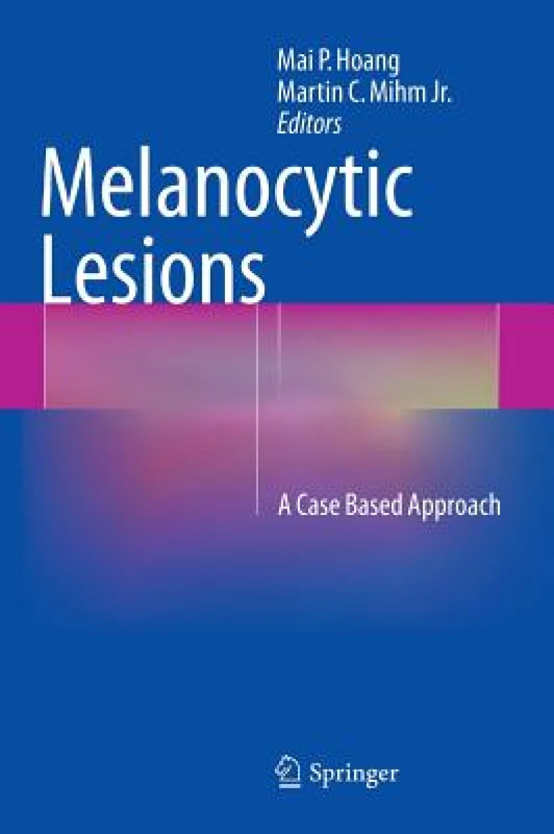 Melanocytic Lesions