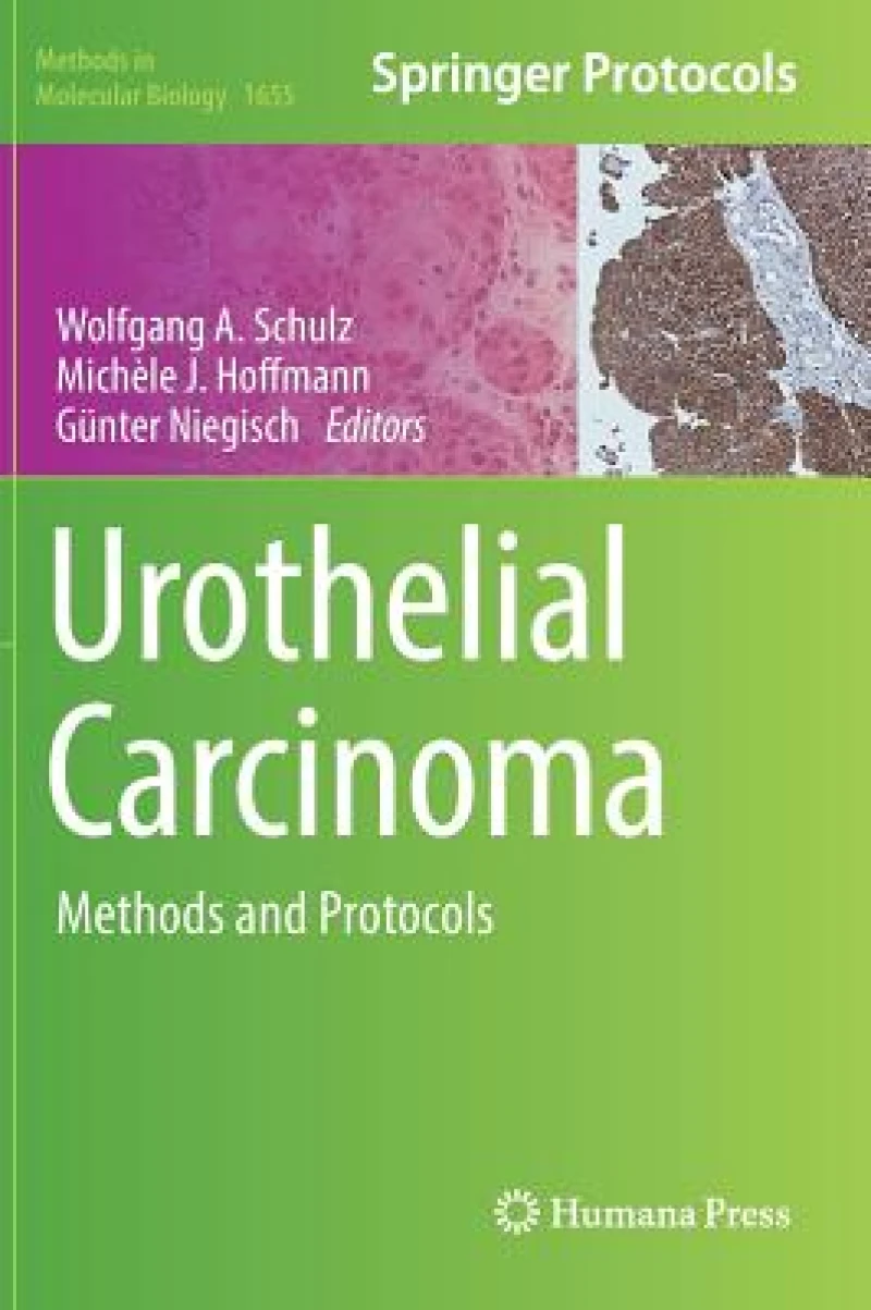 Urothelial Carcinoma