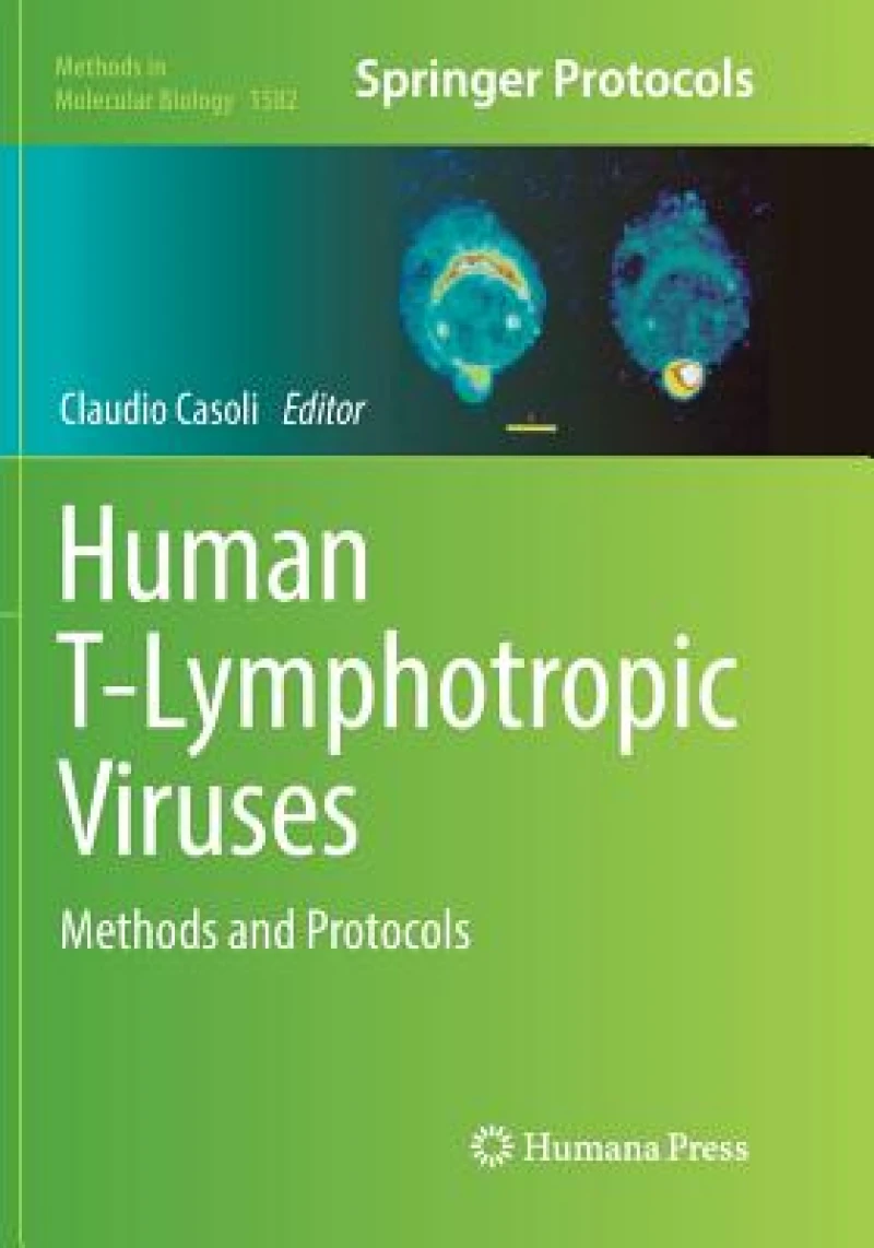Human T-Lymphotropic Viruses