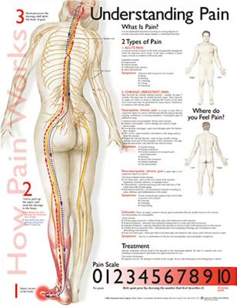 Understanding Pain Anatomical Chart