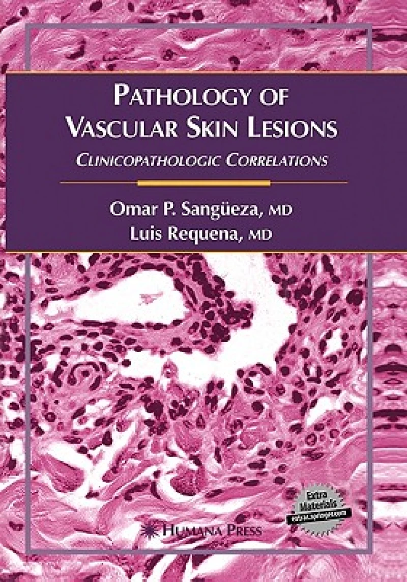 Pathology of Vascular Skin Lesions