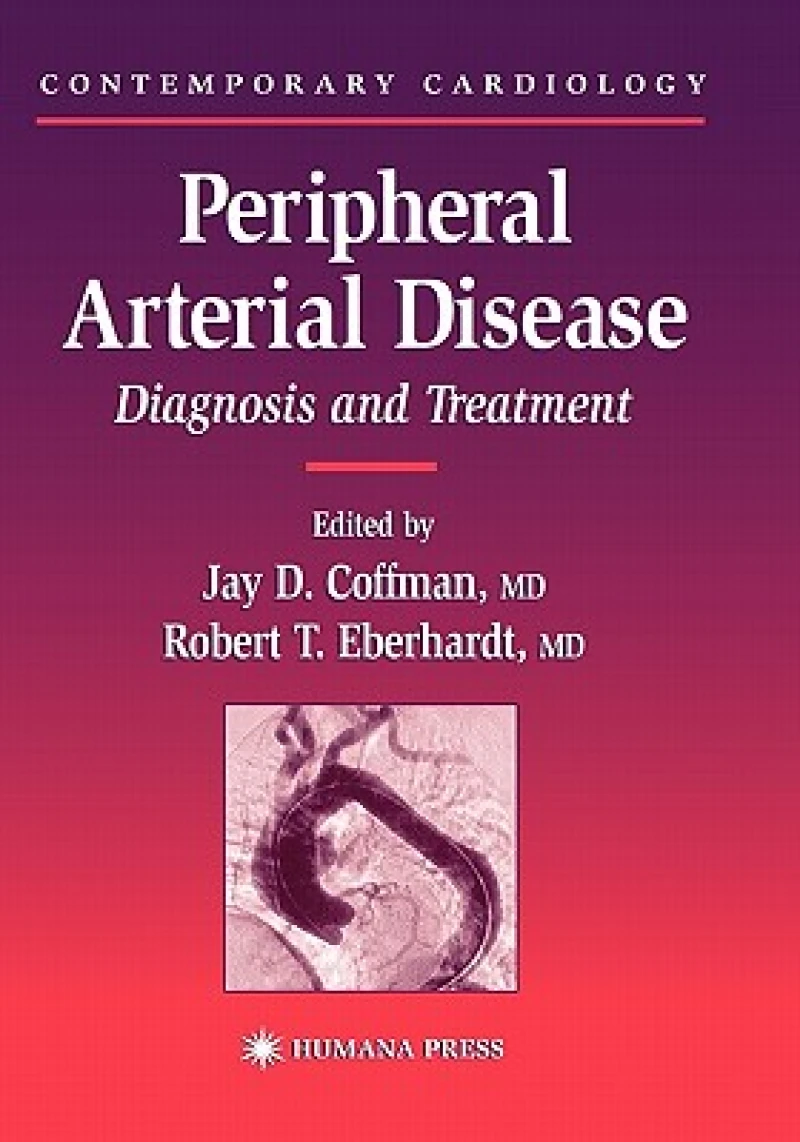 Peripheral Arterial Disease
