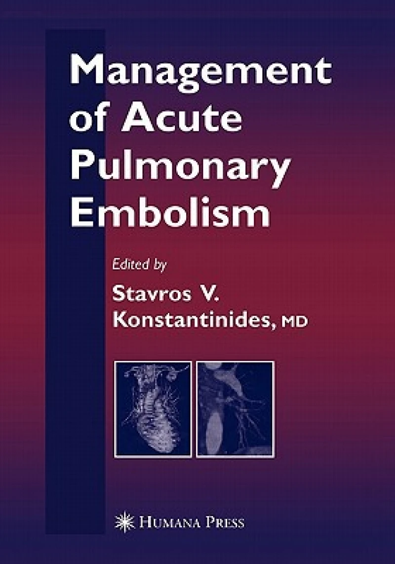 Management of Acute Pulmonary Embolism
