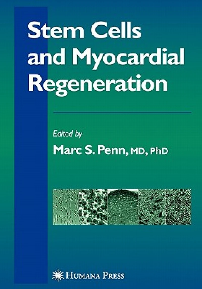 Stem Cells and Myocardial Regeneration