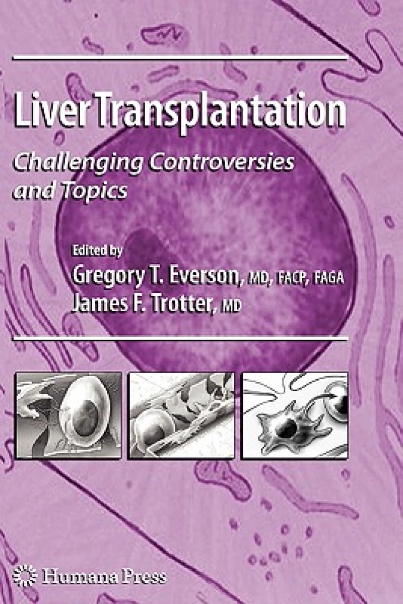 Liver Transplantation