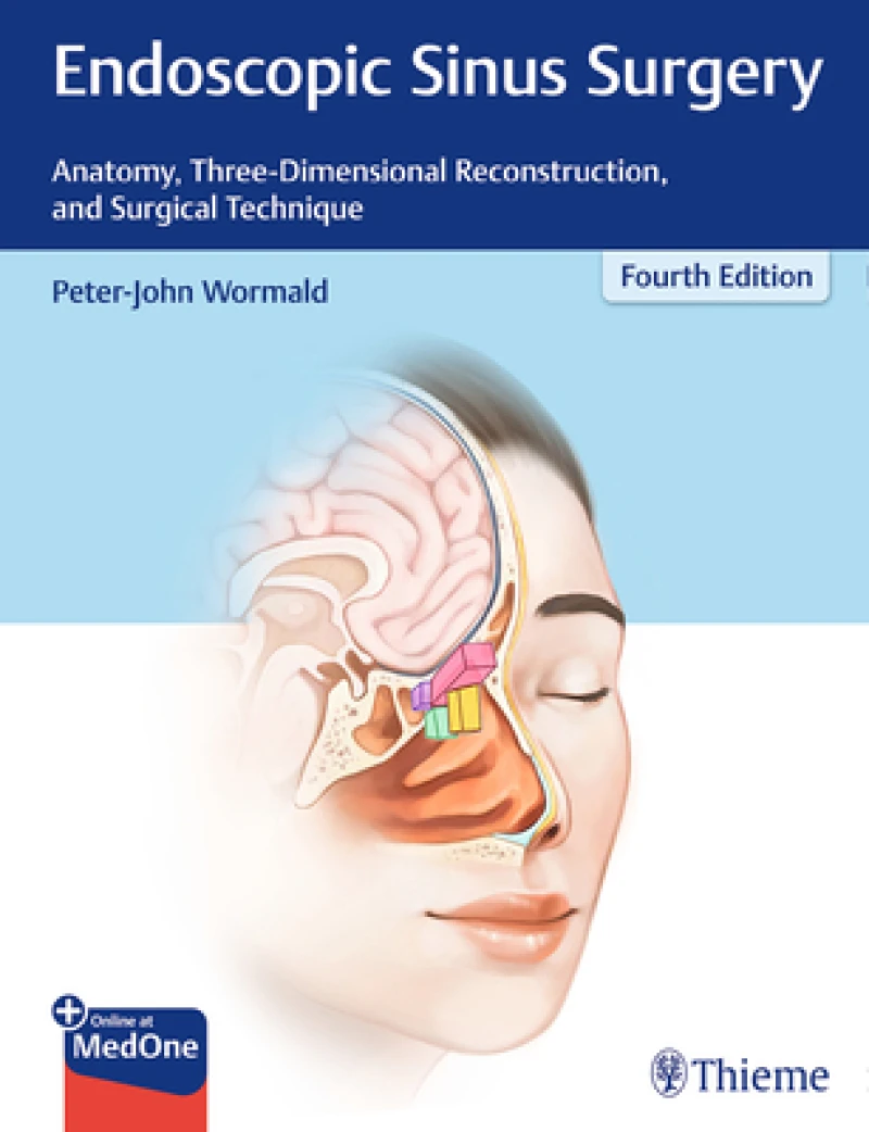 Endoscopic Sinus Surgery