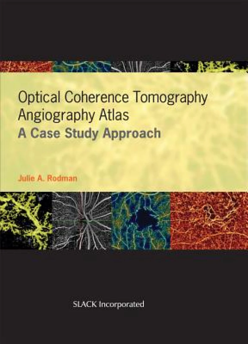 Optical Coherence Tomography Angiography Atlas