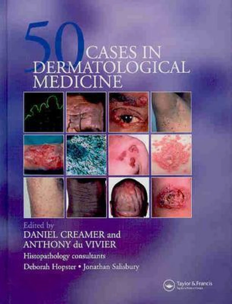 Fifty Dermatological Cases