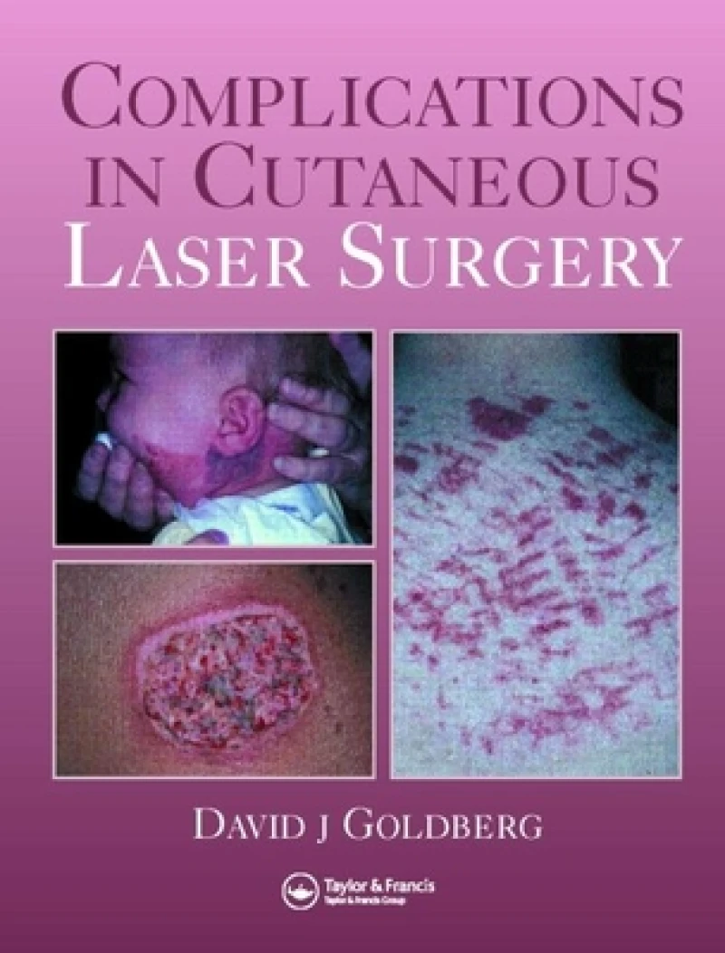 Complications in Laser Cutaneous Surgery