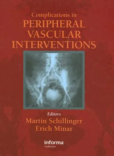 Complicatons in Peripheral Vascular Interventions