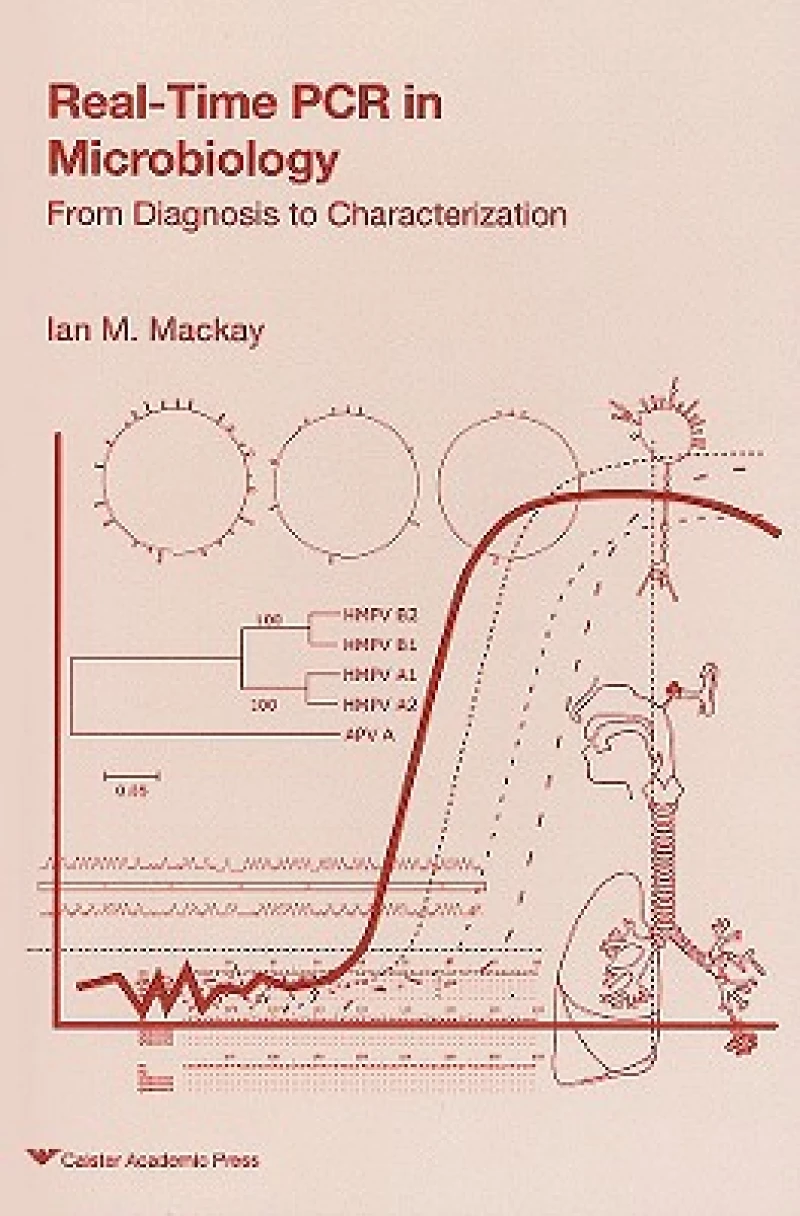 Real-time PCR in Microbiology