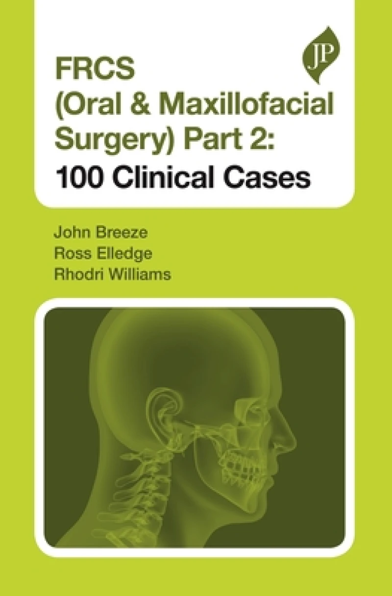 FRCS (Oral & Maxillofacial Surgery) Part 2: 100 Clinical Cases